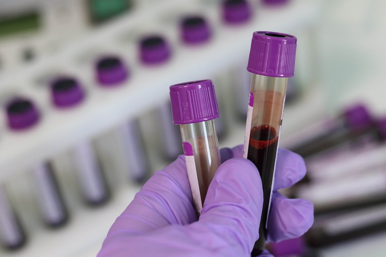 Hematology unit